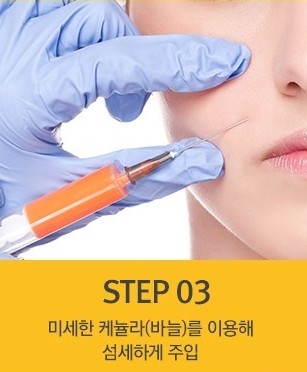 세월의 흔적을 감추는 매끈한 손등! JW정원성형외과 손등지방이식 관련 이미지 4