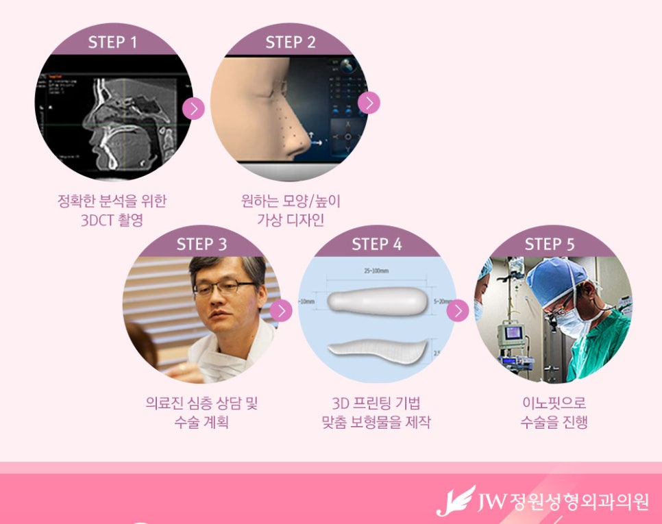 나에게 딱맞는 코수술, 3D맞춤보형물로 자연스럽게 관련 이미지 6