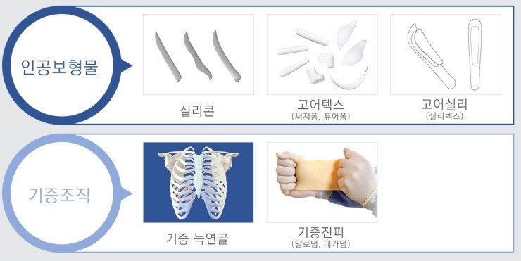 남자코성형도 역시! JW정원성형외과! 관련 이미지 4