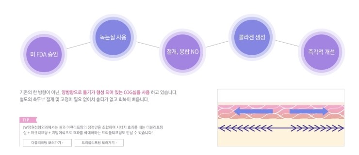 절개 없이 탄력 있는 브이라인! JW정원성형외과 실리프팅으로 관련 이미지 5