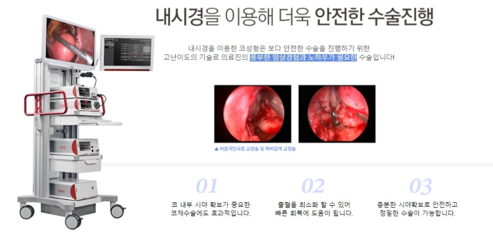The Standard of Golden Ratio Bulbous Nose Surgery! JW Garden Plastic Surgery image 9