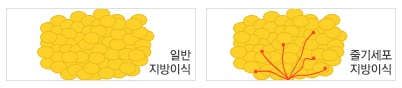 JW정원성형외과 자가지방이식▶ 시간이 지나면 지방이 다 흡수되나요?? 관련 이미지 1