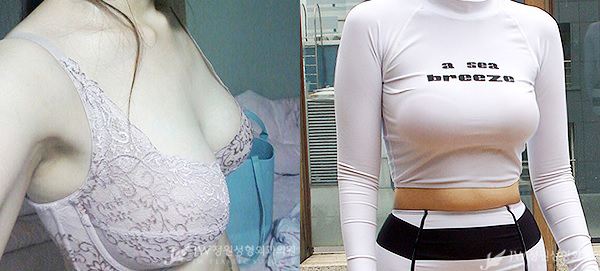 비대칭, 처진가슴 교정도 역시 JW정원성형외과에서! 관련 이미지 4