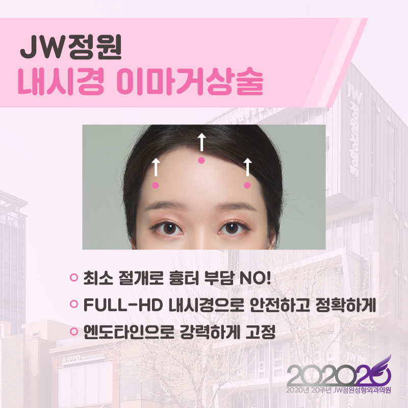 이마거상술, 내시경이마거상으로 안전성과 오랜 지속효과까지 관련 이미지 4