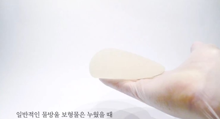 JW정원성형외과 모티바가슴성형 보형물의 특별함▶중력에 따라 물방울로 변화 관련 이미지 5