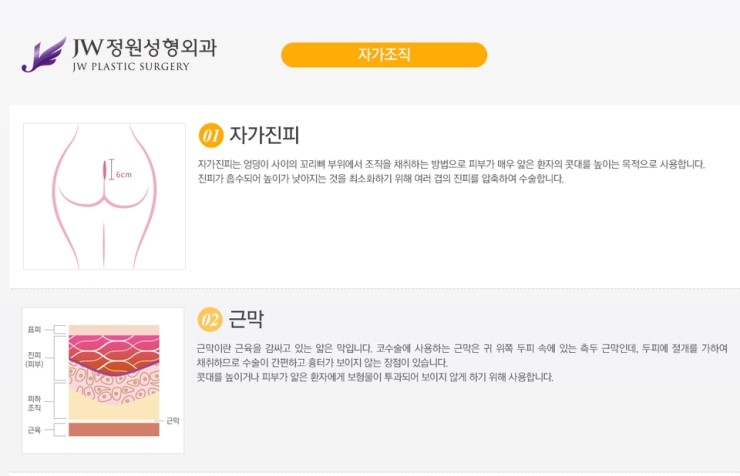 [JW정원성형외과] 낮은코를 개선해주는 낮은코성형 알아봐요! 관련 이미지 7