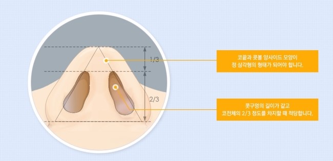 세련되고 아름다운 코라인! JW정원성형외과 복코교정으로 관련 이미지 3