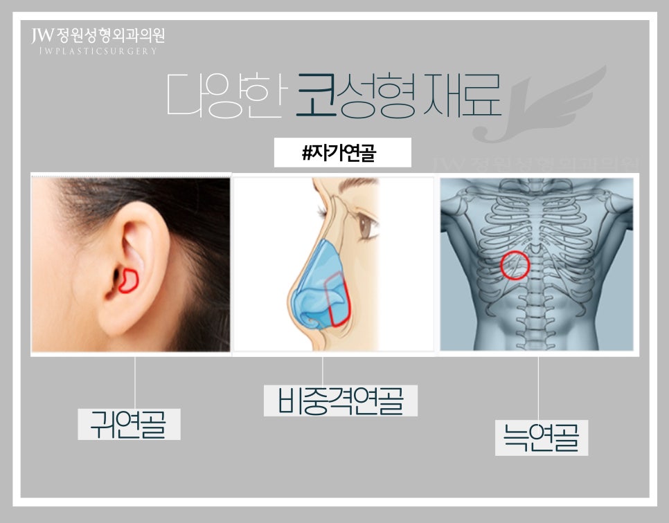 JW Male Rhinoplasty for a Refined Straight Line image 10