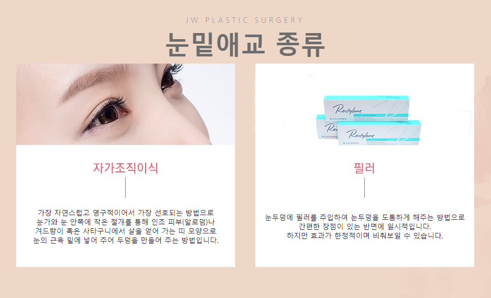 정원 눈밑애교살수술, 눈밑 볼륨을 채워 생기있고 귀엽게! 관련 이미지 3