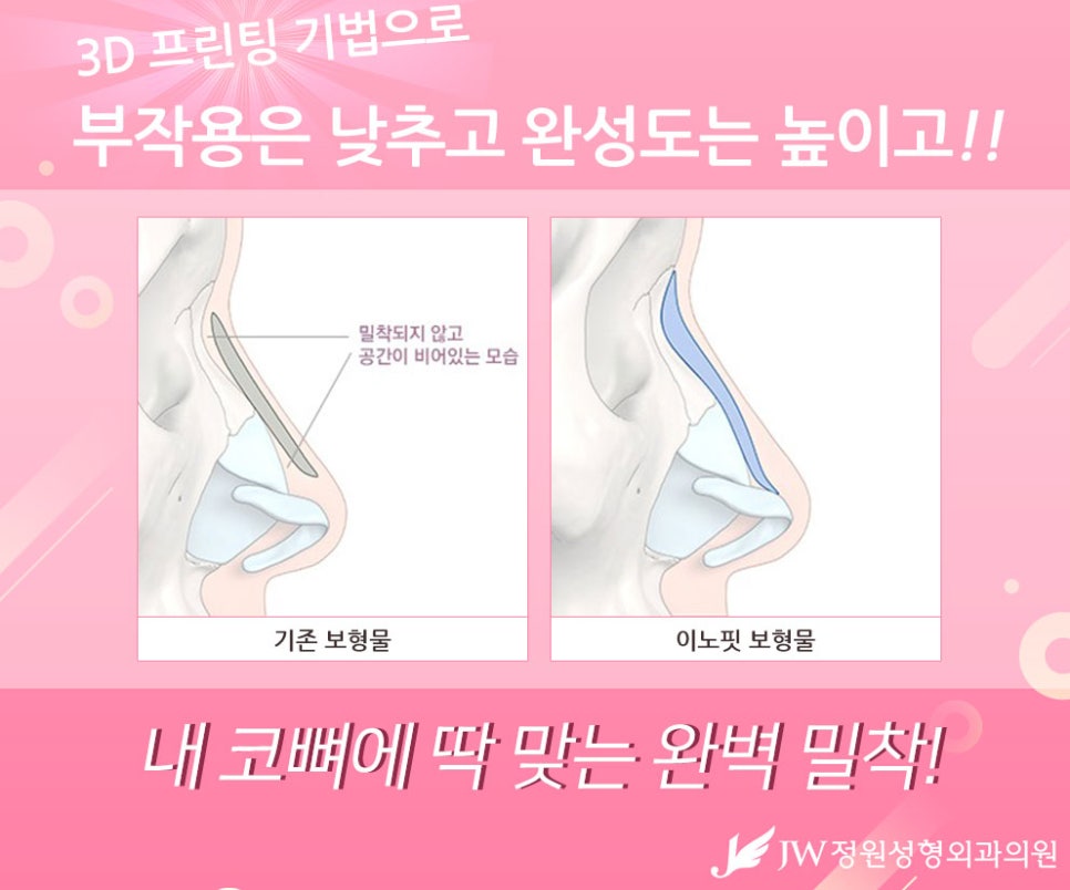 나에게 딱맞는 코수술, 3D맞춤보형물로 자연스럽게 관련 이미지 7