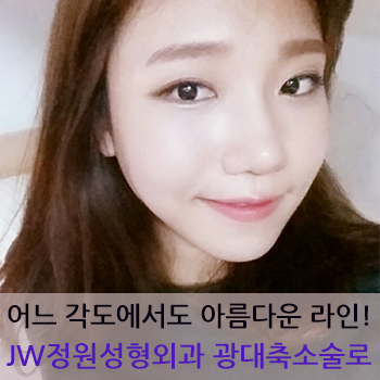 어느 각도에서도 부드럽고 아름다운 얼굴라인! JW정원성형외과 광대축소술로 관련 이미지 1