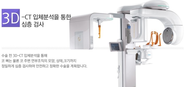 《JW정원성형외과》3D-CT를 이용한 코성형으로 예뻐져볼까⊙⊙ 관련 이미지 1