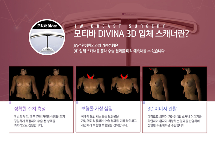 가슴확대수술 보형물종류를 고민한다면 설철환 원장님의 모티바가슴성형! 관련 이미지 5