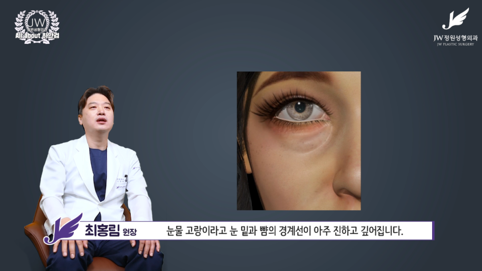 강남하안검수술 눈밑노화 개선하기 위해  【JW정원성형외과】 관련 이미지 3