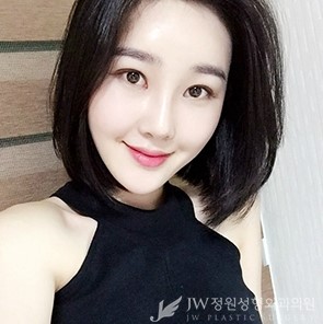 눈재수술! 병원선택부터 신중하게! JW정원성형외과 쌍꺼풀 재수술 관련 이미지 2