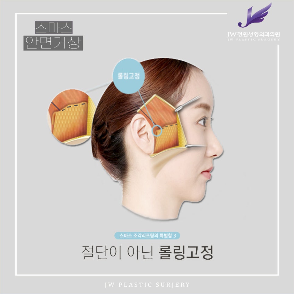 SMAS Facelift!? Just Right for Facial Wrinkle Lifting! image 9