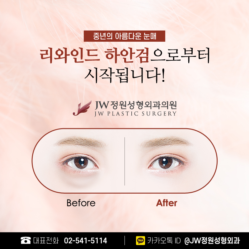 중년눈성형 생기 넘치는 눈매 【강남 JW정원성형외과】 관련 이미지 5