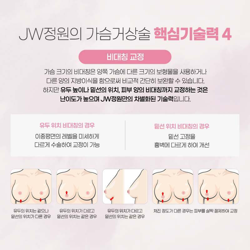 A Breast Lift Procedure Review to Regain Femininity image 6
