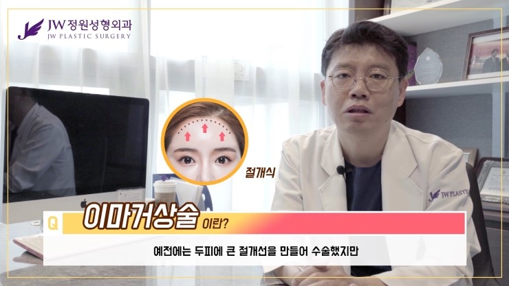 [JW정원성형외과] 눈매교정 후 두꺼워 보이는 눈두덩이, 어떻게 없앨 수 있을까요? 관련 이미지 22