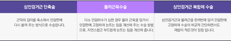 피곤해보이는 졸린 눈을 생기 있게 바꾸는 눈매교정술 관련 이미지 4