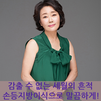 감출 수 없는 세월의 흔적, JW정원성형외과 손등지방이식으로 말끔하게! 관련 이미지 1