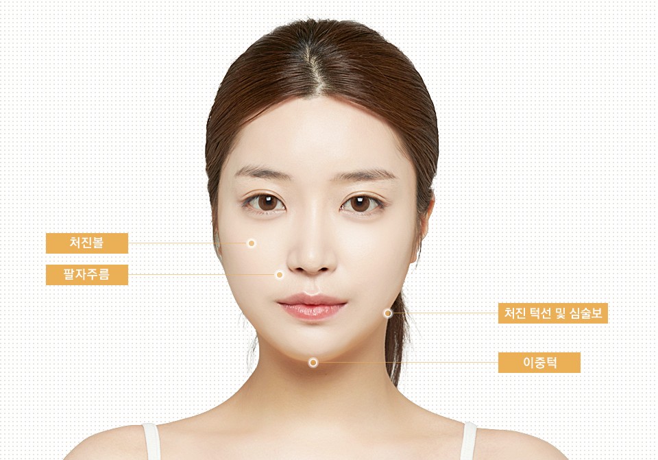 [JW Jeongwon Plastic Surgery] Sagging cheeks and a collapsed facial line! Compress and lift with a double lifting procedure image 7