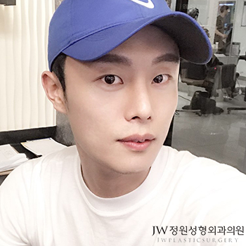무보형물 복코성형, 콧볼축소수술후 자신감 뿜뿜 관련 이미지 1