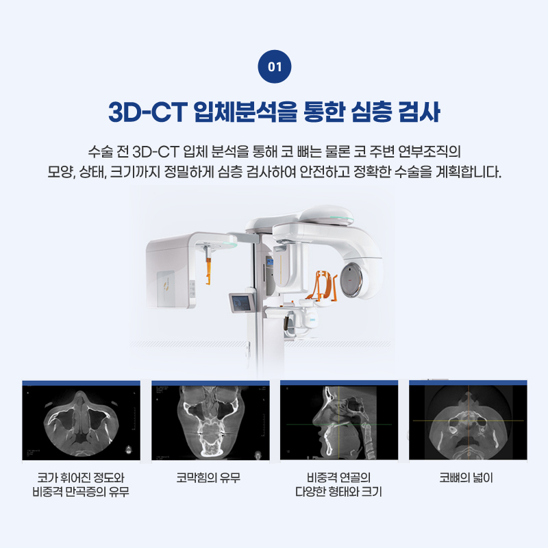 코재수술병원 원인부터 해결할 수 있도록 관련 이미지 3