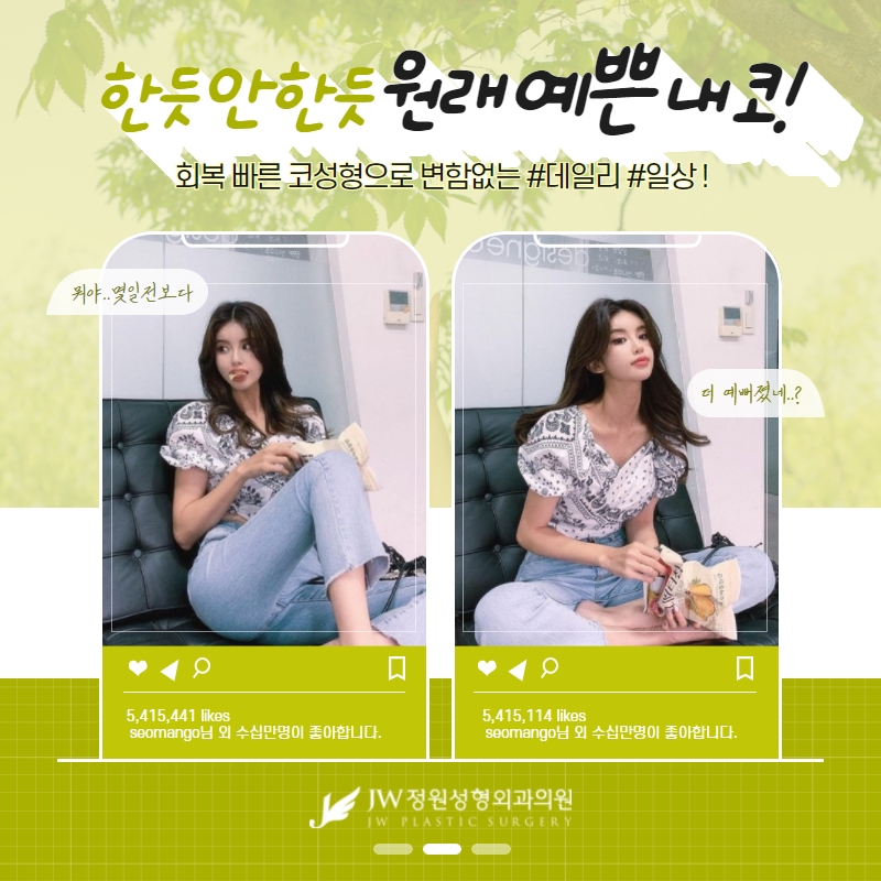 빙글빙글 돌아가는 무보형물 코수술 [코끝성형] 관련 이미지 3