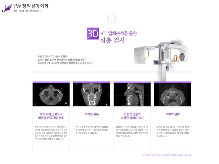 [JW정원성형외과] 매부리코성형, 매부리코성형 잘하는 곳에서 고민해결! 관련 이미지 9