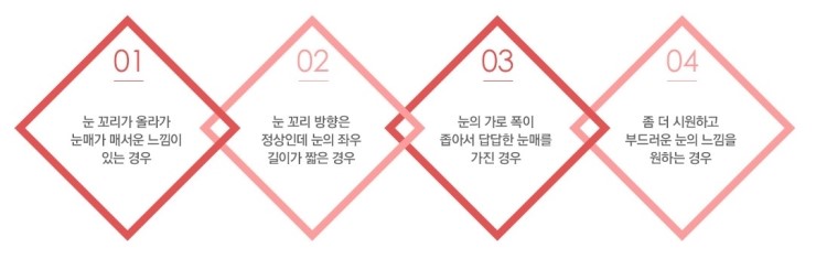 시원하고 자연스러운 눈매! JW정원성형외과 트임수술 관련 이미지 4