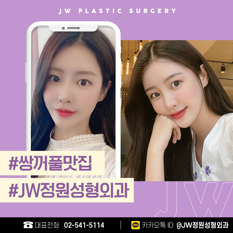 A Hospital That Excels at Double Eyelid Surgery, a Place That Fills in the Beauty of the Eye Area 【Gangnam JW Garden Plastic Surgery】 image 1