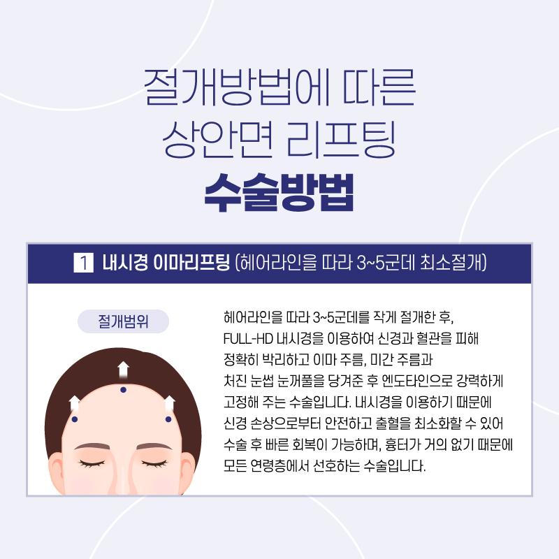 이마거상후기 리프팅으로 쫙 올라간 효과는 관련 이미지 3