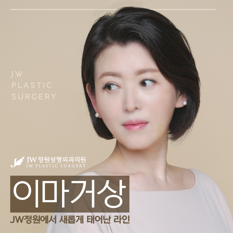 이마거상후기 리프팅으로 쫙 올라간 효과는 관련 이미지 1