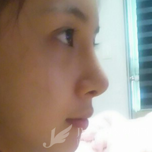 코재수술도 역시 JW정원성형외과 서만군원장 :] 관련 이미지 4
