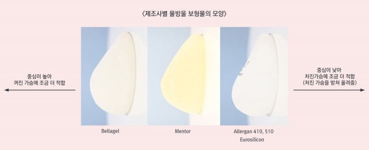 출산과 다이어트로 처진 가슴! JW정원성형외과 처짐교정 확대술! 관련 이미지 6
