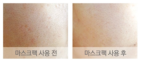 닿는 순간 다르다! 18년 노하우 JWC마스크팩 출시! 관련 이미지 3
