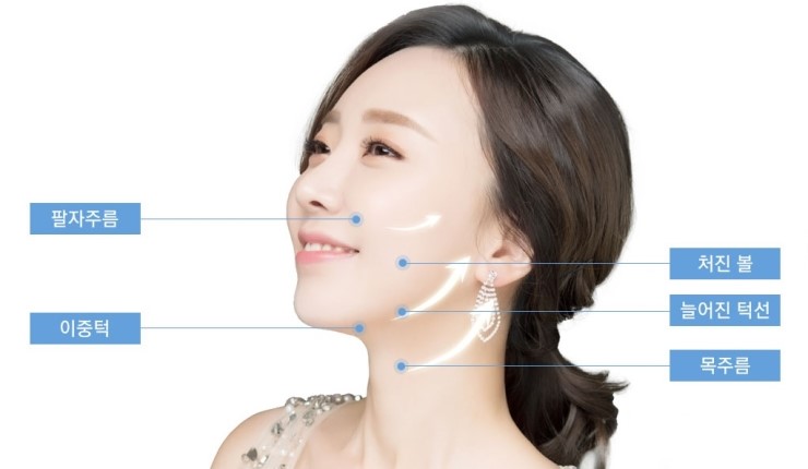 보다 탄력있게 오랜 지속효과까지! JW정원성형외과 엘라스티꿈 리프팅 관련 이미지 6
