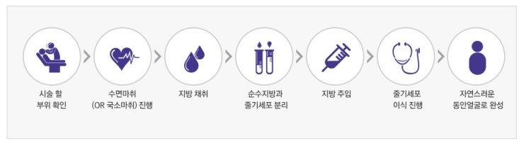 세포재생으로 더욱 안전하고 오래 유지되는 JW정원 줄기세포 지방이식 관련 이미지 4