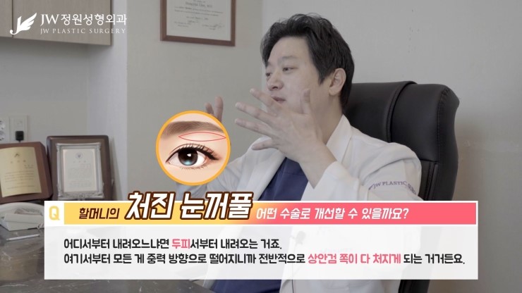 [JW정원성형외과] 할머니의 처진눈꺼풀.. 무슨수술을 해야할까요? 관련 이미지 10