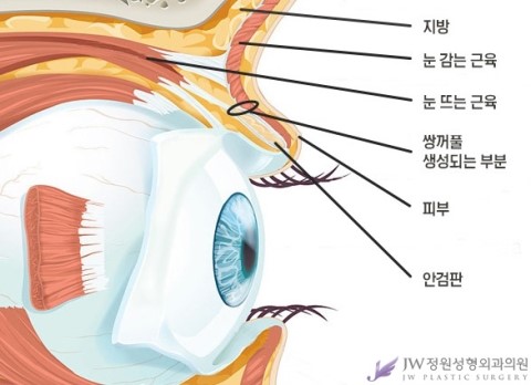 내 눈에 어울리는 쌍꺼풀 라인은? JW정원성형외과 쌍꺼풀수술 관련 이미지 1