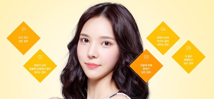 자연스럽고 오뚝한 코, JW정원성형외과 낮은코성형 관련 이미지 7