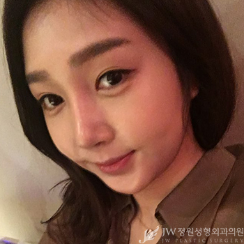 [눈재수술] 트임 복원술도 역시 JW정원성형외과! 관련 이미지 2