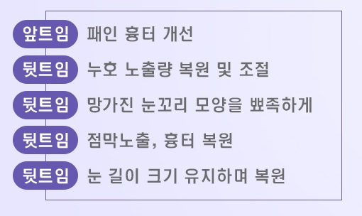 트임 재수술, 복원수술도 역시 JW정원성형외과! 관련 이미지 2