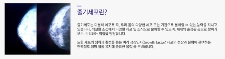 내 것으로 채우는 진짜 볼륨감! JW정원성형외과 줄기세포 가슴확대 관련 이미지 3