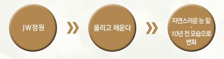 내 인상 그대로, 10년 전으로 돌아가는 JW정원성형외과 리와인드 하안검 관련 이미지 2