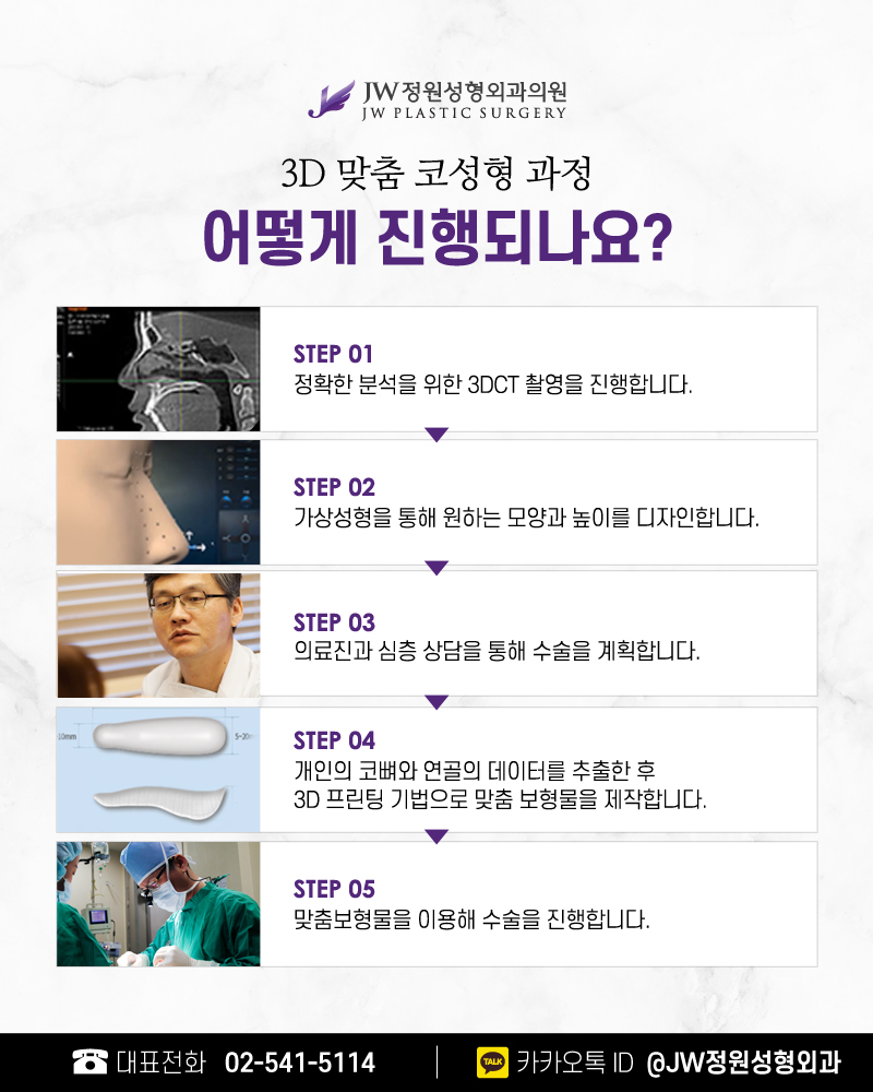 코보형물 오직 나의 코만을 위하는 【강남 JW정원성형외과】 관련 이미지 3