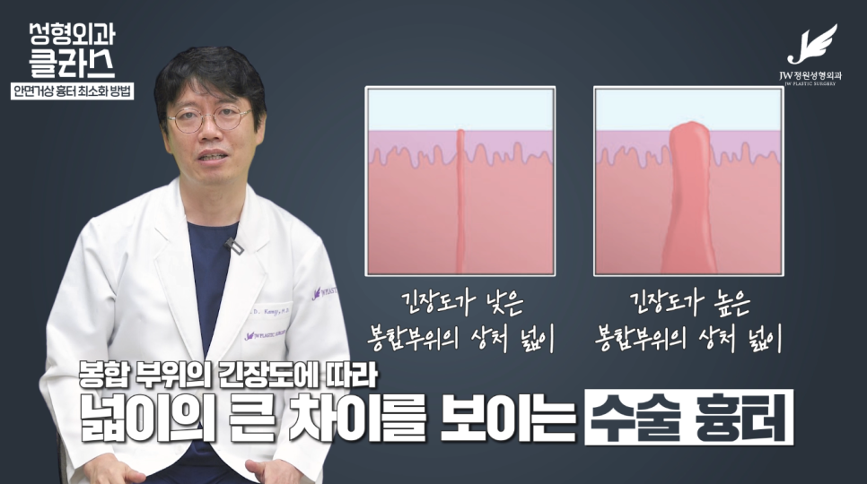 안면거상술후기 흉터 걱정 없이 깔끔하게!  【강남 JW정원성형외과】 관련 이미지 11