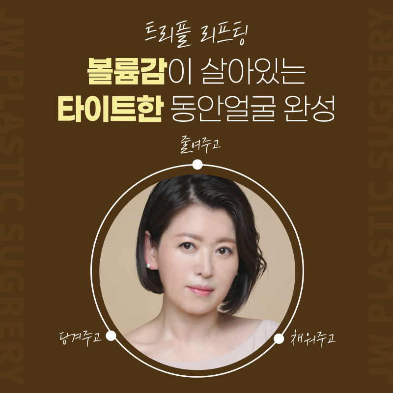 얼굴리프팅효과 셀카에도 자신있는 미모 【강남 JW정원성형외과】 관련 이미지 4