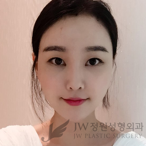 이마눈썹리프팅,눈매교정술,앞트임복원,코성형,지방이식 &rArr; JW정원성형외과에서! 관련 이미지 2